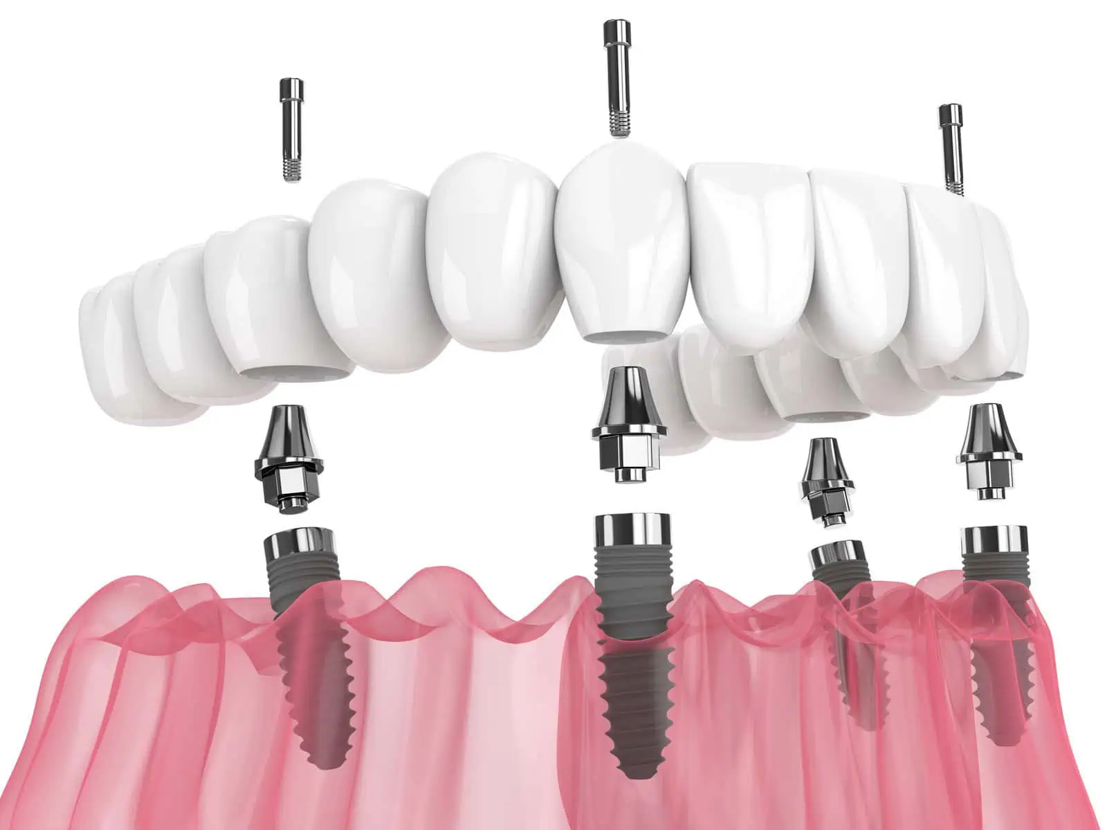 Loudoun Valley Oral Surgery